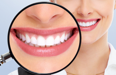  Root Canal Treatment Painless